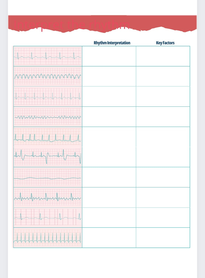 EKGs Workbook