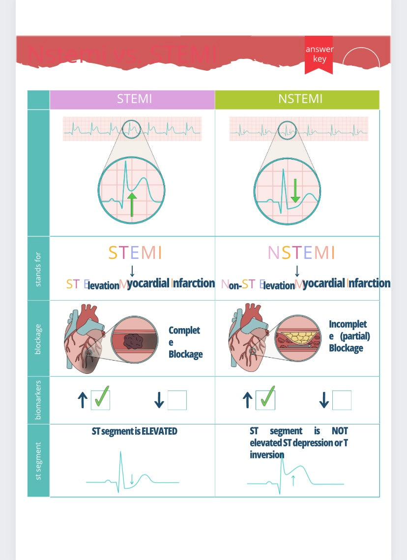 EKGs Workbook